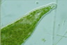 Microdalyllia