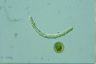 Ophiocytium gracillimum