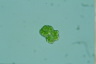 Botryococcus braunii