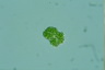 Botryococcus braunii