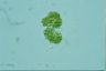 Botryococcus braunii