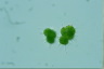 Botryococcus braunii