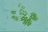 Botryococcus sudetica