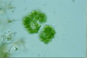 Botryococcus sudetica