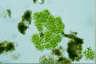 Botryococcus sudetica