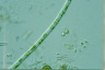 Microspora