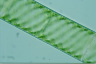 Spirogyra