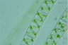 Spirogyra