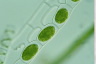 Spirogyra