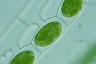 Spirogyra