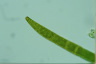 Closterium intermedium