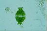 Euastrum ampullaceum