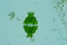 Euastrum ampullaceum