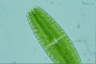 Netrium digitus