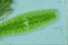 Netrium digitus