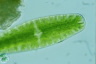 Netrium digitus