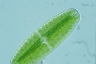 Netrium digitus