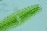 Netrium digitus