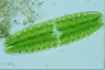 Netrium digitus