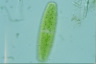 Netrium digitus