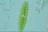 Netrium digitus