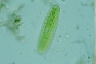 Netrium digitus