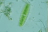 Netrium digitus