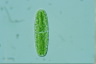 Netrium oblongum