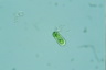 Cylindrocystis