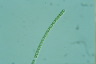 Sphaerozosma