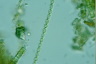 Sphaerozosma