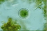 Acanthocystis