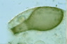 Hyalosphenia