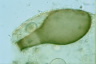 Hyalosphenia