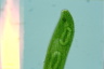 Euglena spirogyra