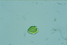 Gonyostomum depressa