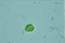 Gonyostomum depressa