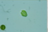 Gonyostomum depressa