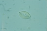 Diploneis yatukaensis