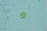 Pediastrum simplex