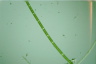 Spirogyra