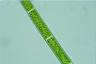 Spirogyra