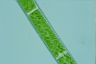 Spirogyra