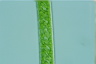 Spirogyra