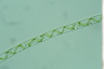 Spirogyra