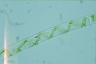 Spirogyra