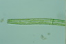 Pleurotaenium trabecula