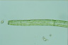 Pleurotaenium trabecula