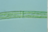 Pleurotaenium trabecula