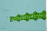 Pleurotaenium nodosum